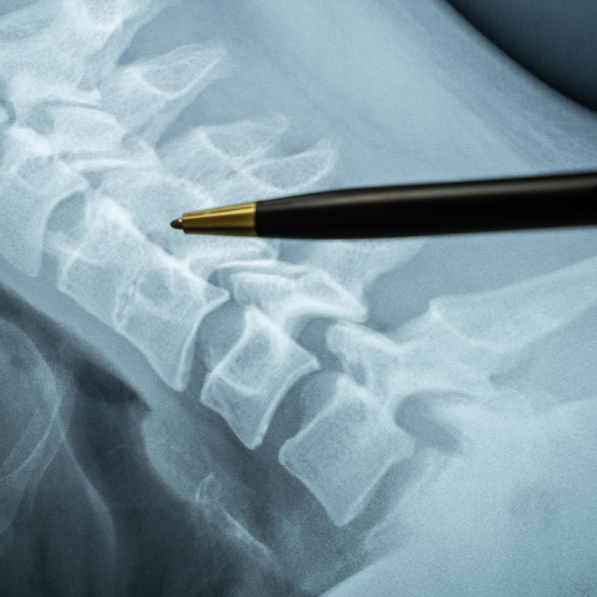 gibraltar_radiology_interventional_radiology_bowral_03